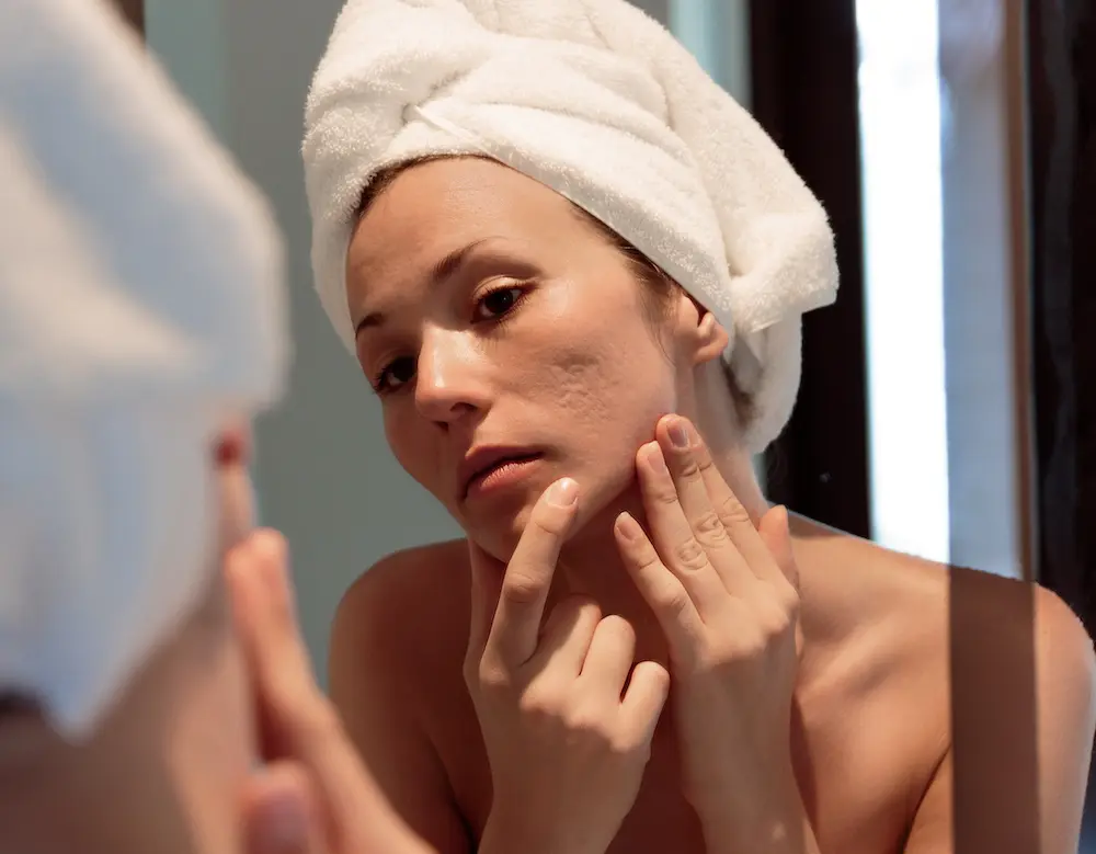 Augenoberlider nach einer Lidstraffung in der Dermatologie Friedensengel