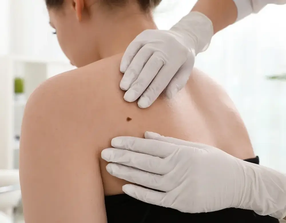 Hyaluron und Filler bei Mutter und Tochter